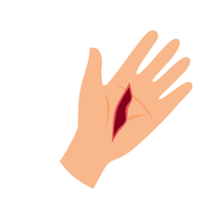 wound