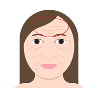 wrinkle